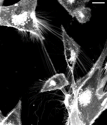 Confocal microscope image of living human U87 glioblastoma cells Glioblastoma_TNT_2
