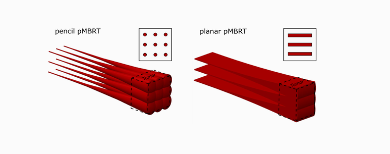 pMBRT_schematic2.png