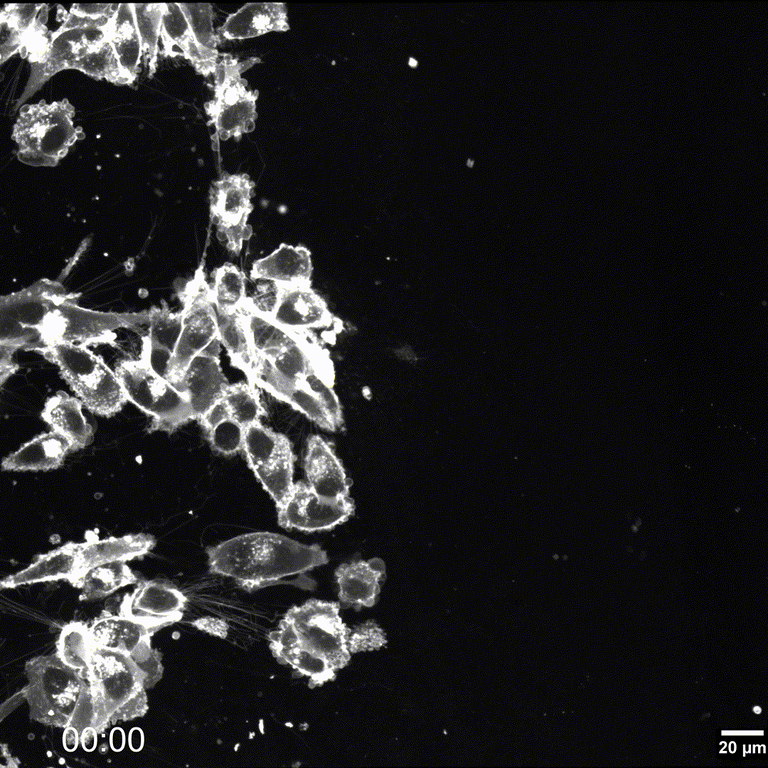 Fluoreszenzangefärbte, migrierende, menschliche U87 Glioblastomzellen. Aufgenommen mit unserem hochauflösenden STED-Mikroskop mit integrierter Klimakammer. An der vordersten Migrationsfront sind feine Verbindungslinien (Tunneling Nanotubes) zwischen den Zellen zu sehen.