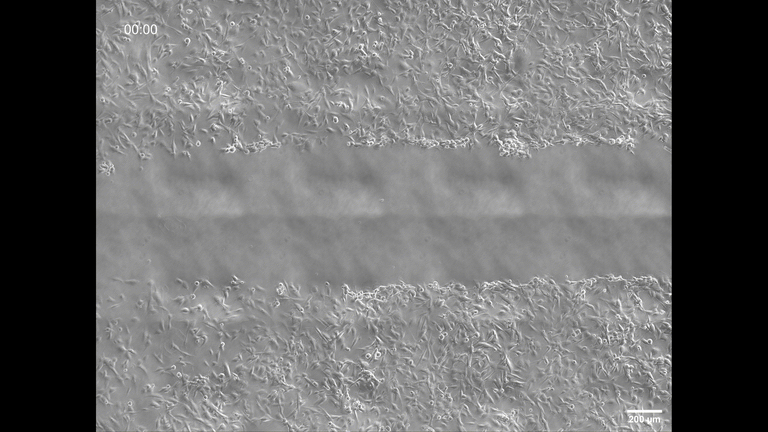 Migrierende, menschliche U87 Glioblastomzellen unter dem Phasenkonstrastmikroskop.