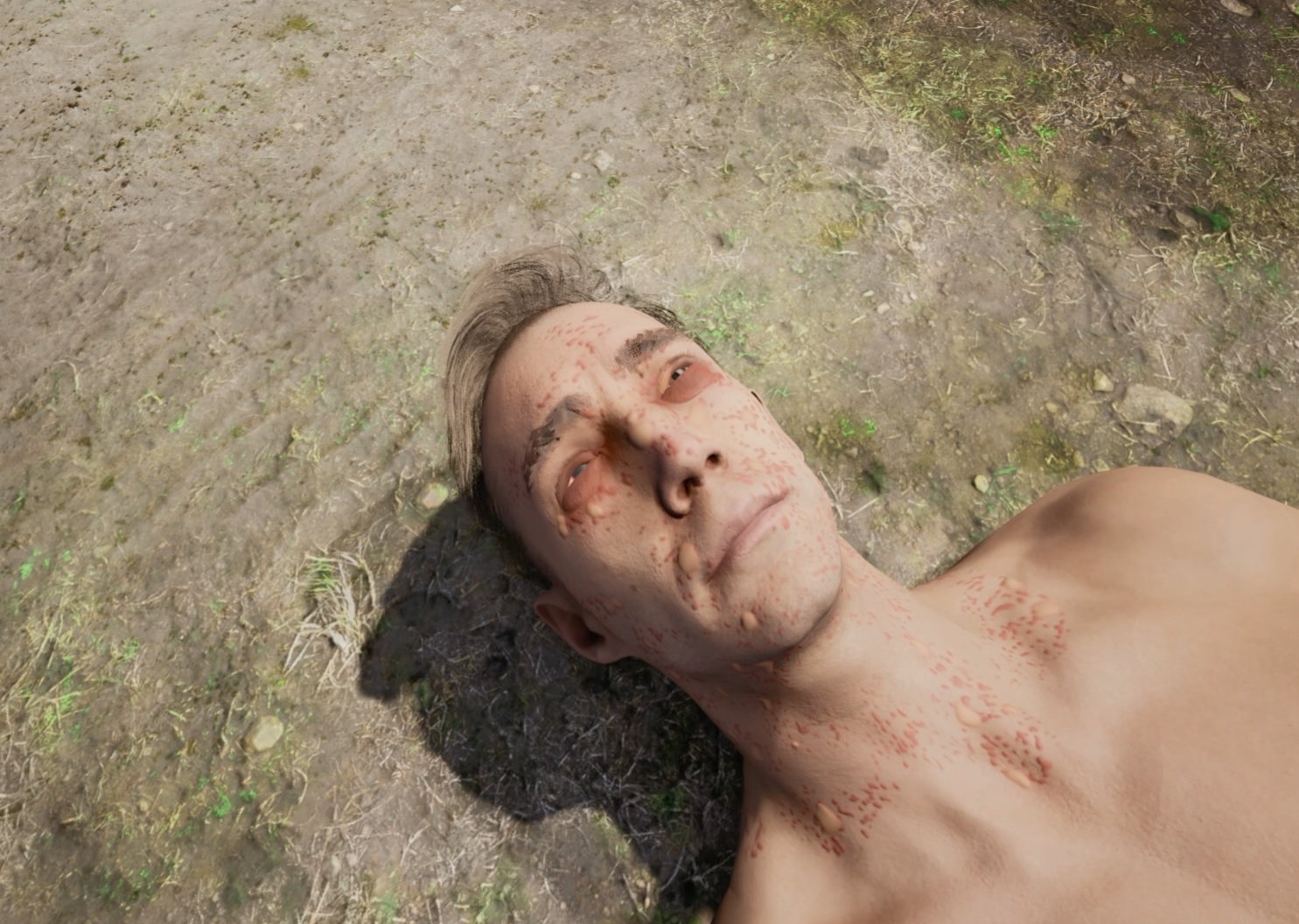 Die Patientensimulation baut auf dem Physiologiemodell auf, welches für das Training der Ersthelfer-Bravo bei der Bundeswehr konzipiert wurde. Dieses Physiologiemodell für konventionelle Traumen unterstützt das Training der Verwundetenversorgung bei Combat Related Injuries nach dem TCCC Algorithmus. Die Vitalzeichen für Combat Related Injuries wurden bei der Erweiterung des Physiologiemodells durch jene für C-Kampfstoffe ergänzt. Die Wirkungsprinzipien einiger Gruppen chemischer Kampfstoffe wurden formal beschrieben und können so an bereits implementierte pathophysiologische Prozesse im Physiologiemodell gekoppelt werden.